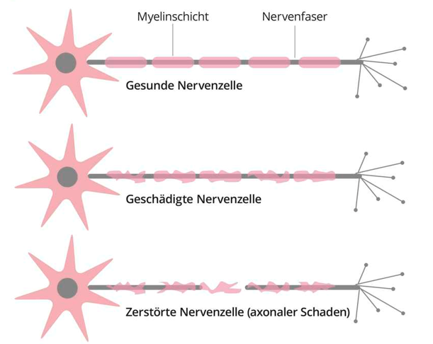 Nervensystem Nervensystem
