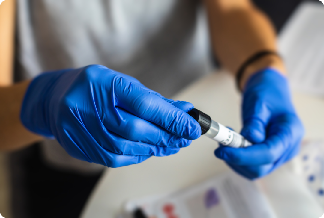 Zwei Hände in blauen Latexhandschuhen halten ein geschlossenes Reagenzglas .